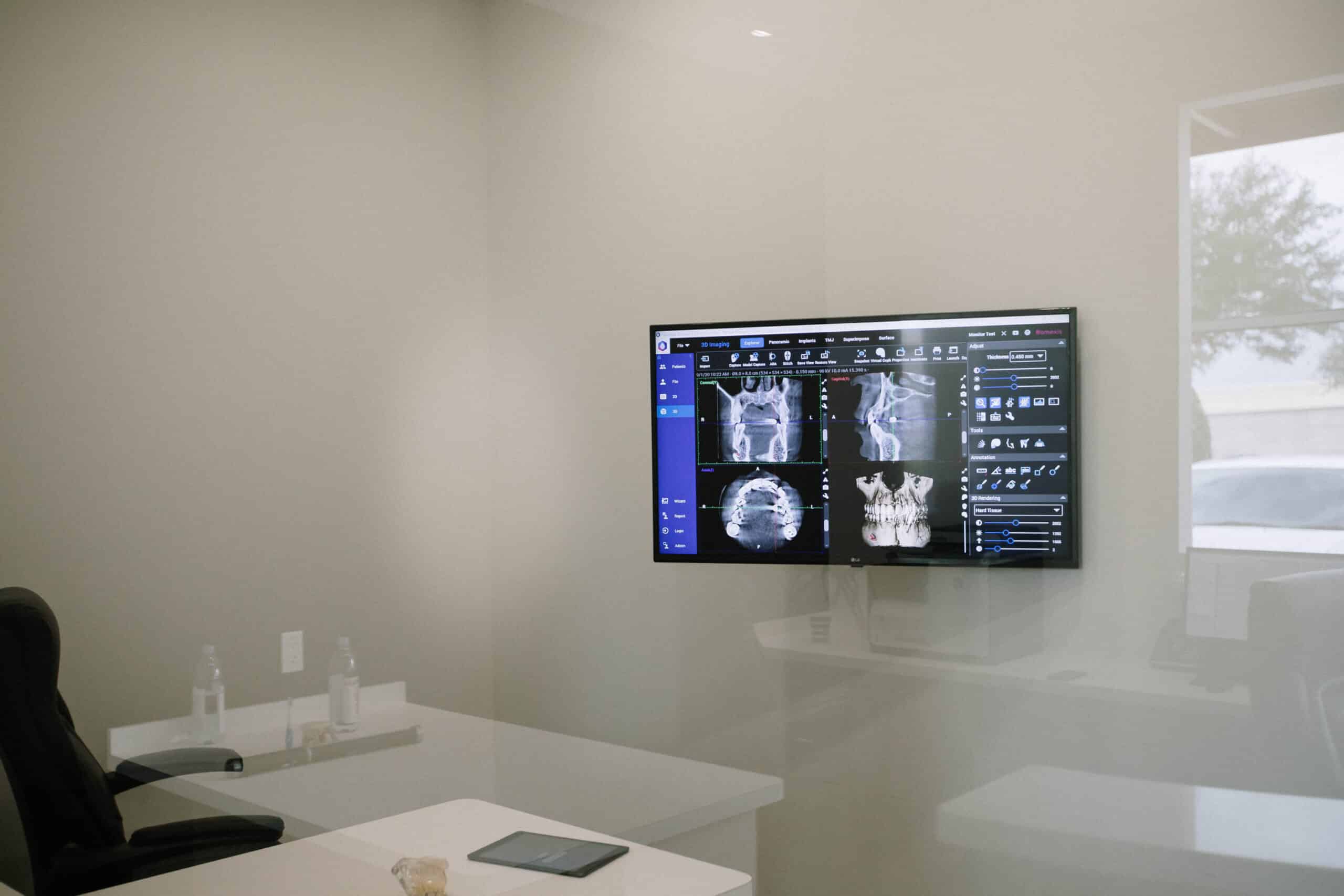 Can Dental Implant Cause Tinnitus?