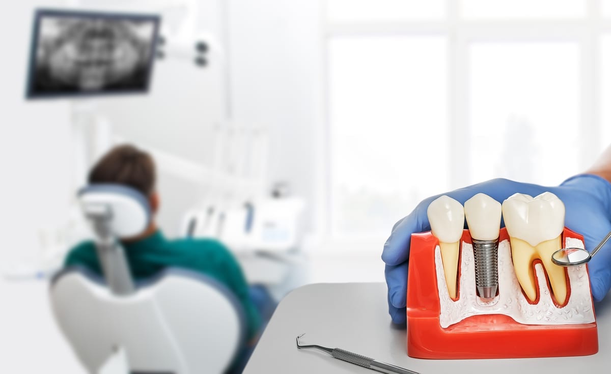 Dental Bridges in Richmond