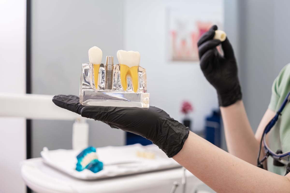 Dental Crowns in Richmond